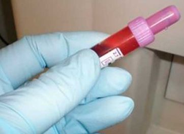 Laboratorio de Análisis Clínicos Cobo López Esther doctor con muestras de sangre